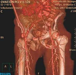 pelvisscandm2511 468x460